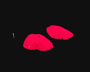 RIDGES - SLOPERS 1 [Chapter]